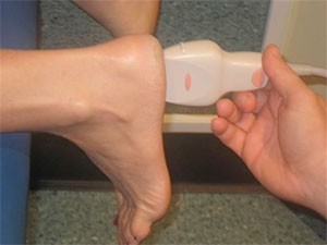 Ultrasound for diagnosing plantar fasciitis