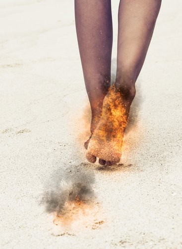 Burning Feet Causes, Dr. Bob Baravarian