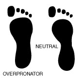 Wet feet test and overpronation, Dr. Bob Baravarian