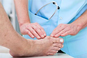 Bunion Treatment options Dr. Bob Baravarian Los Angeles