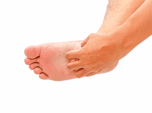 Itchy Feet, Eczema on Foot, Dr. Bob Baravarian Los Angeles