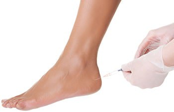Botox Dysport fot Plantar Faciitis Treatment 