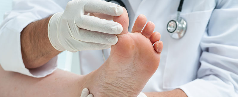 Diabetic Foot Exams, Dr. Bob Baravarian