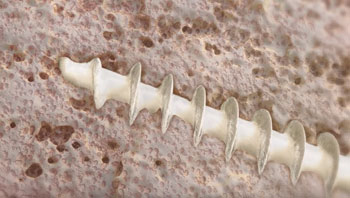 OssioFiber at its initial state at implant