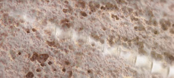 OssioFiber implant at resorb