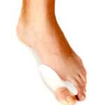 Bunion Myths -- Dr. Bob Blog