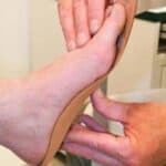 Small Toe / Pinky Toe Pain