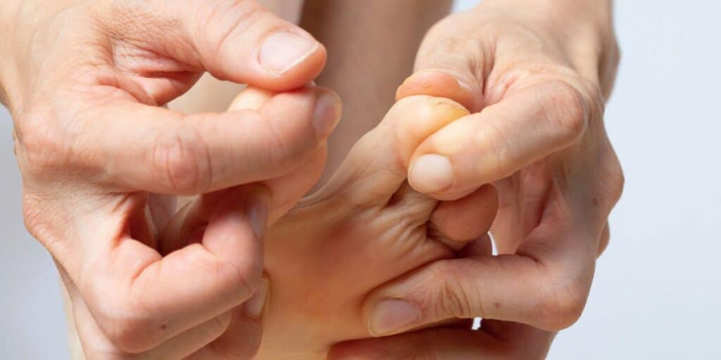 Let’s Talk Metatarsalgia and Capsulitis of the Second Toe
