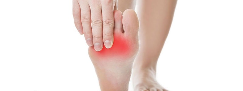 Metatarsalgiar Capsulitis of the Second Toe, Podiatrist Los Angles