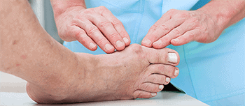 Orthopedist treating bunion