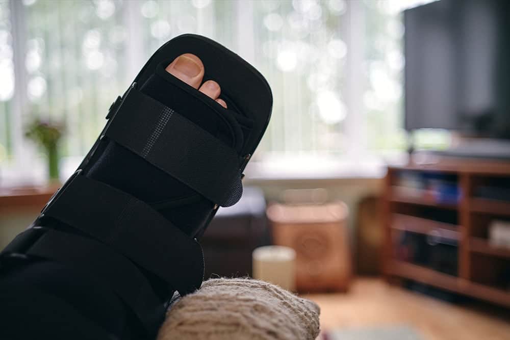 Preparing your home for bunion surgery recovery