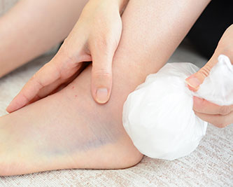 Bag of ice being held to bruised heel