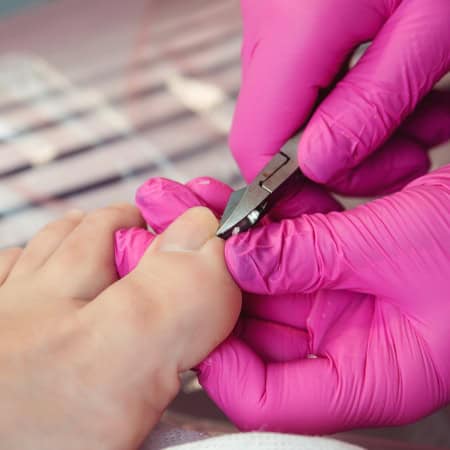 Treating ingrown toenail