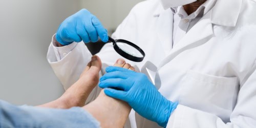 See a doctor for an ingrown toenail