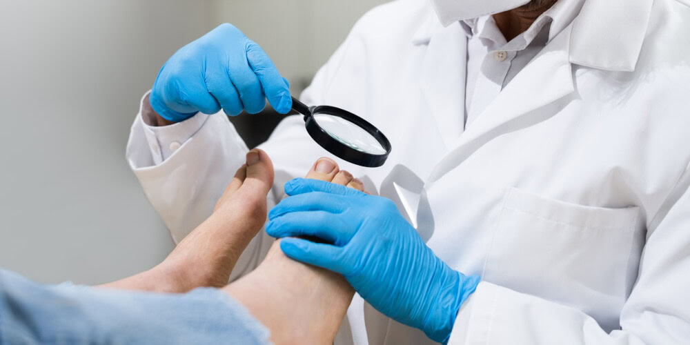 Doctor examining ingrown toenail
