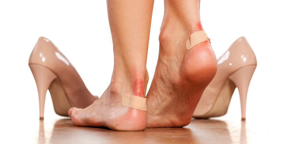 Woman with heel blisters from wearing high heeled shoes