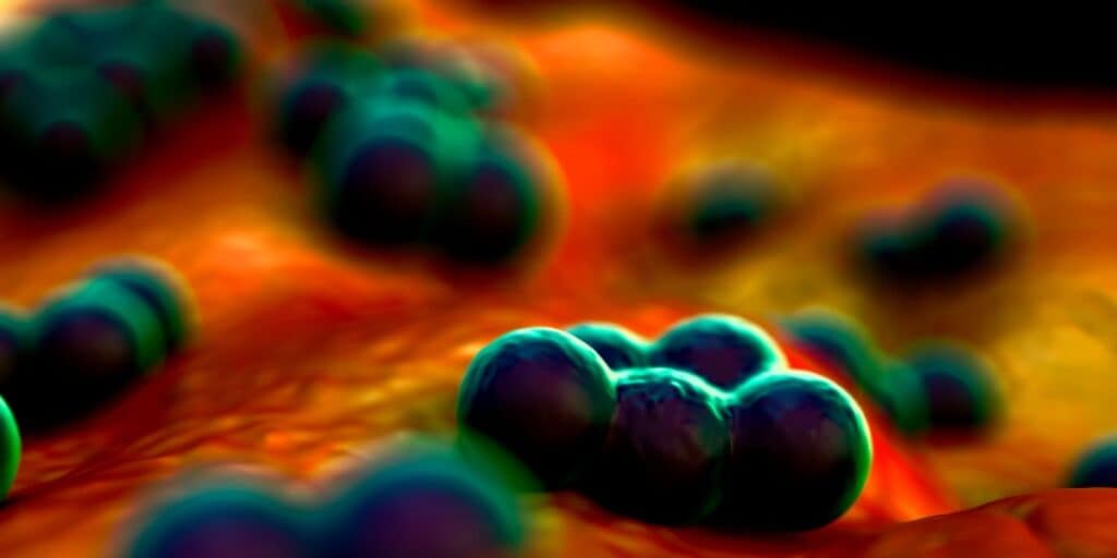 Illustration of MRSA
