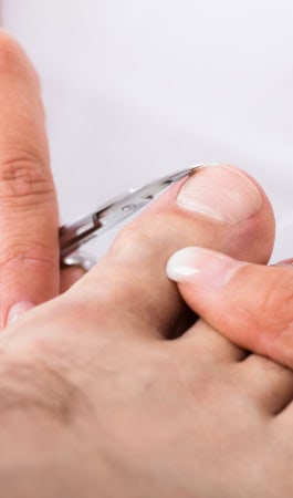 Infected Ingrown Toenail
