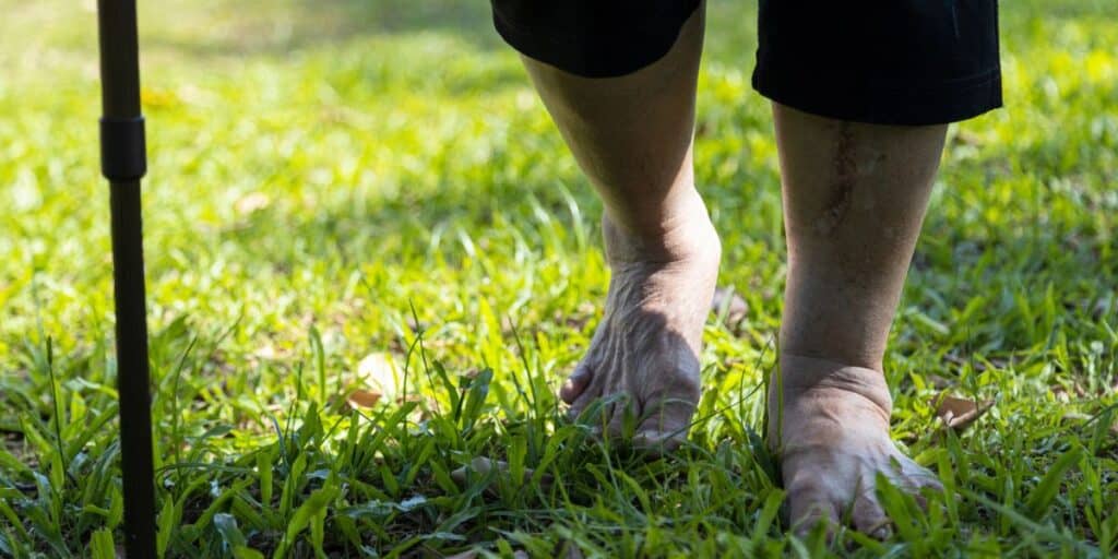 Aging feet_DrBob