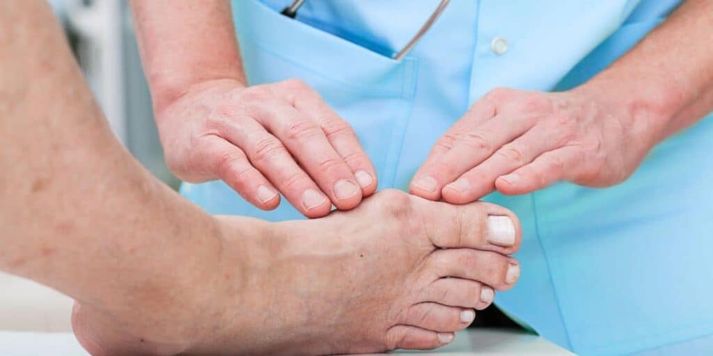 Is Bunion Surgery Covered By Insurance