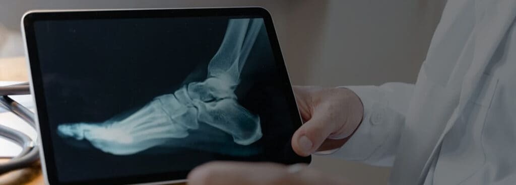 Foot x-ray