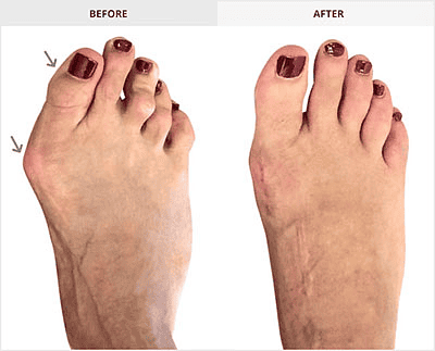 brown-nails-feet