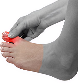 Revision Toe Surgery