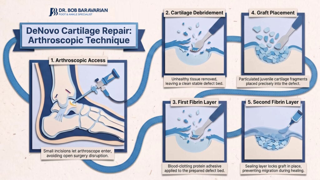 Step-by-step illustration of DeNovo cartilage repair using arthroscopic technique, showing access, cartilage debridement, graft placement, and fibrin layers.