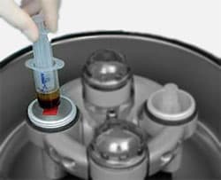 Platelet Rich Plasma (PRP)