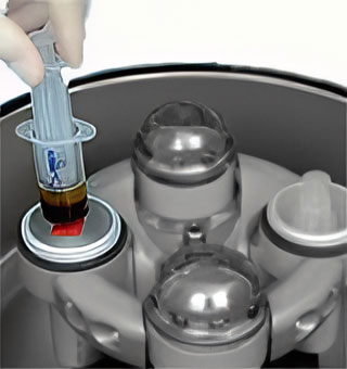 Platelet Rich Plasma (PRP)