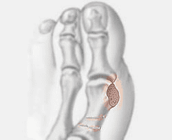 foot