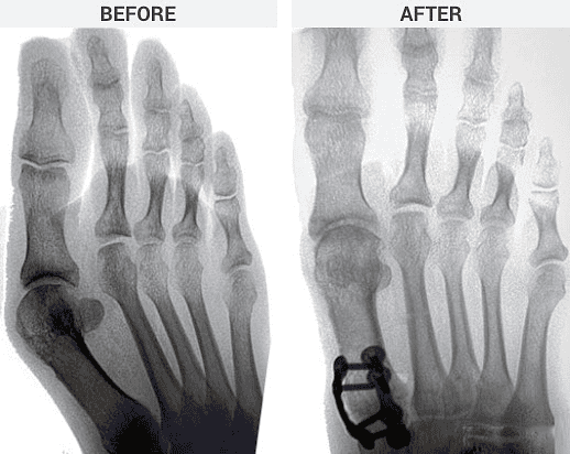 black-feet-skull