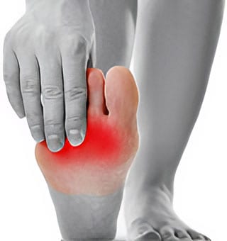 Metatarsalgia (ball of foot pain)