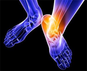 Ankle-Sprain
