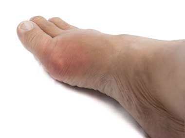 RD-Enlarged-Red-Toe