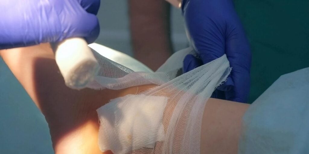 Dr. Baravarian on the Podiatry Today Podcast What bio-integrative fixation means for your foot and ankle surgery
