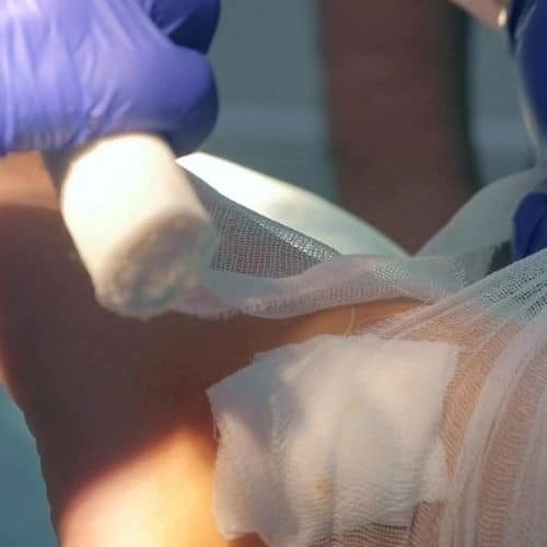 Ankle injury treatment being administered by a healthcare professional with gloves, using medical gauze and bandages on a patient's ankle in a clinical setting.